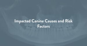 Impacted Canine Causes and Risk Factors at Oklahoma Dental Implants & Oral Surgery